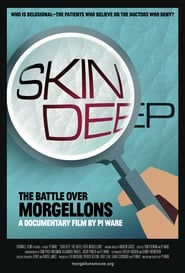 Skin Deep: The Battle Over Morgellons 2019 (پوست عمیق: نبرد بر سر مورگولون ها)